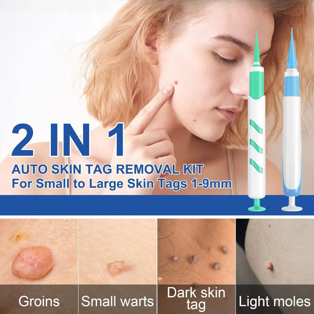 2-IN-1 Auto Skin Tag Removal Tool Kit