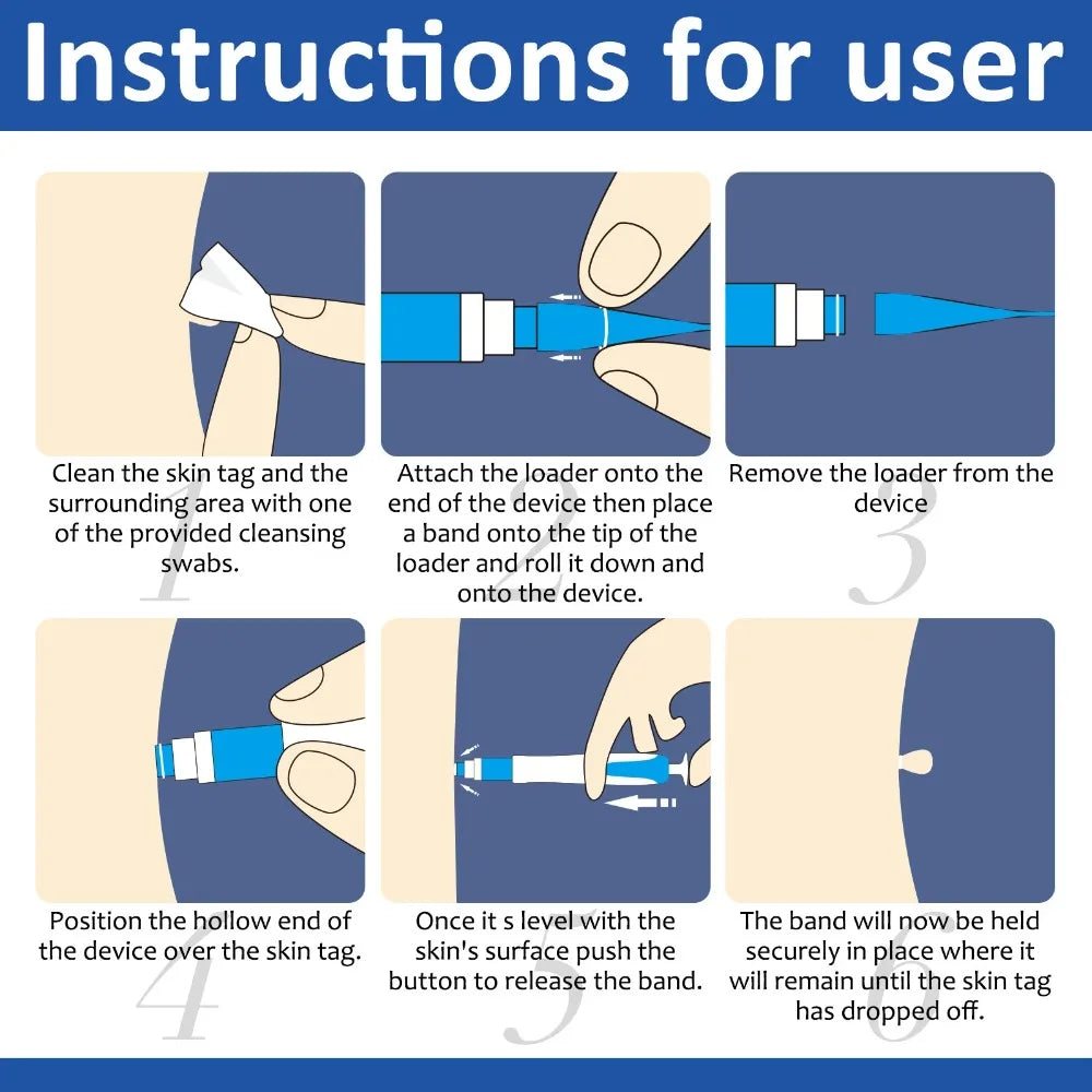 2-IN-1 Auto Skin Tag Removal Tool Kit